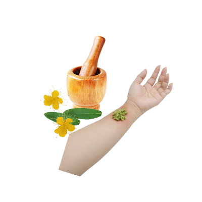 Traditional recipe Bruises from St. John's Wort