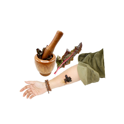 Traditional recipe Stops bleeding from wounds from Rhubarb Chard Swiss