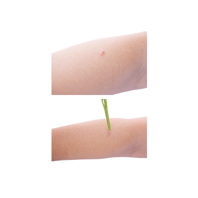Traditional recipe Treating Boils, Swelling, and Snakebite Pain from Bamban