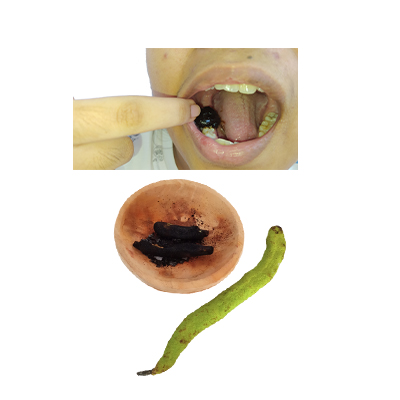 Traditional recipe Toothache from Kluwih