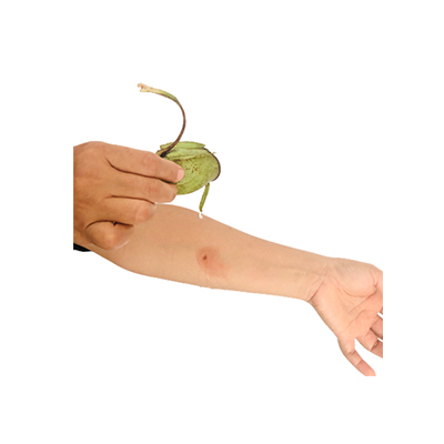 Traditional recipe Treating Burns from Kantung Semar