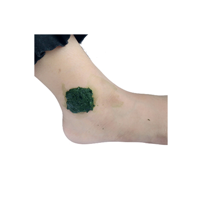 Traditional recipe Treating Sprained Joints from Katang-Katang