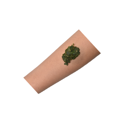 Traditional recipe Wound or Abdominal Swelling Remedy from Rumput Jelumpang