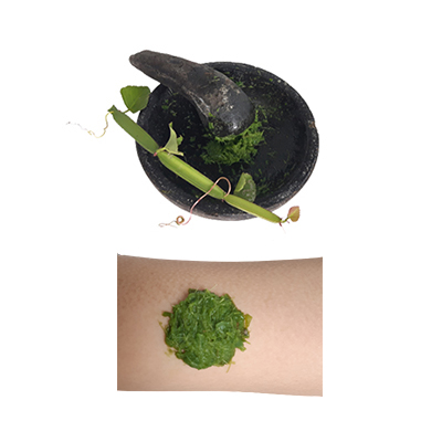 Traditional recipe Treating Wounds, Burns, Boils from Tikel Balung