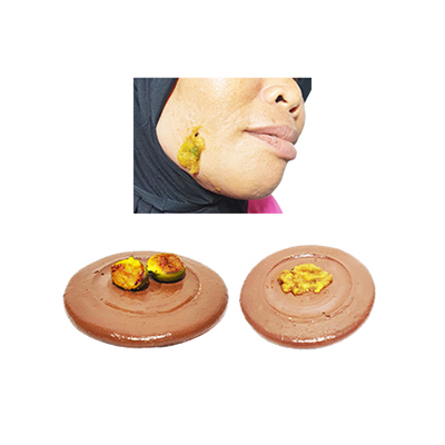 Traditional recipe Swollen Gums or Toothache from Buah Ara