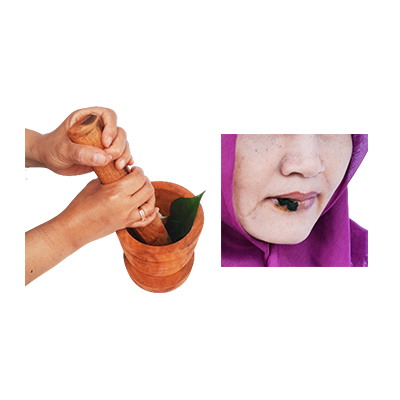 Traditional recipe Canker Sores from Nusa Indah Hutan
