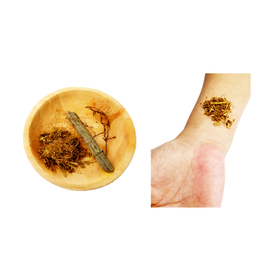 Traditional recipe Treating Wounds from Asoka