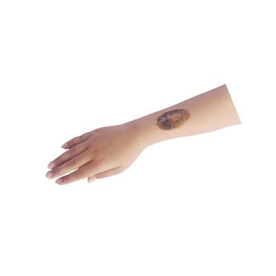 Traditional recipe Skin Wound Remedy from Tekelan