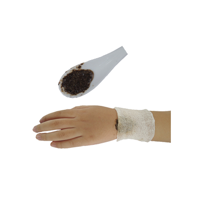 Traditional recipe Treating Broken Bones from Bayam Duri