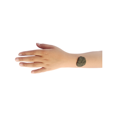 Traditional recipe Bruises or boils from Lidah Ular