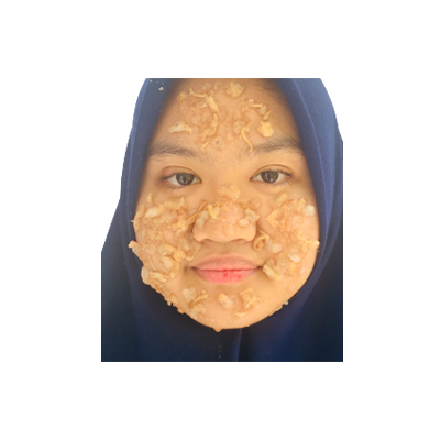 Traditional recipe Treating acne from Rambai