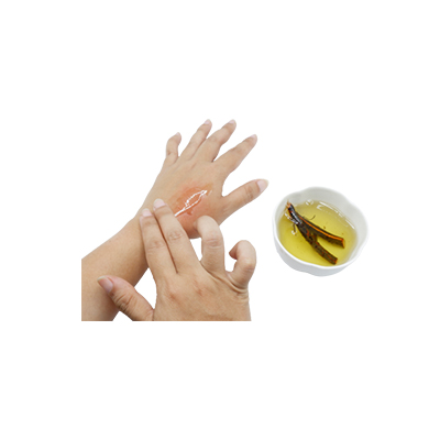 Traditional recipe Itchy wounds from Akar Tuba