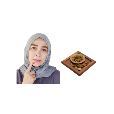 Traditional recipe Acne from Mawar