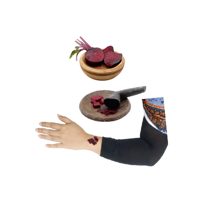Traditional recipe Boils from Bit