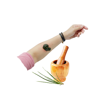 Traditional recipe Burns from Bulbine frutescens